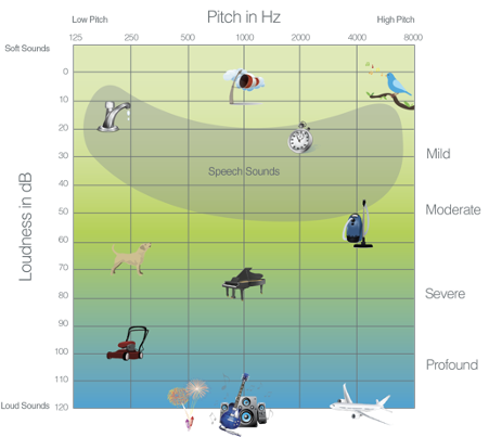 Chart comparing everyday noises by loudness (dB) and pitch (Hz)