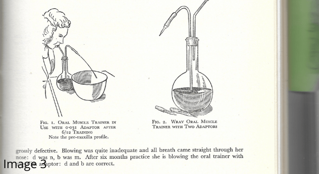 Image 3: Diagram showing a woman blowing into the 'oral muscle trainer'