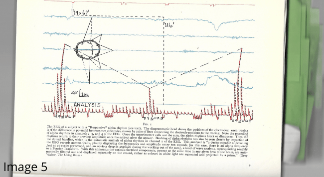Image 5: electroencephalogram (EEG) graph