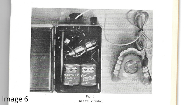 Image 6: Scanned page featuring a black and white photo of an early laryngeal vibrator for laryngectomy patients